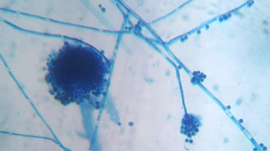 Aspergillus sp. Lactophenol Blue Stain