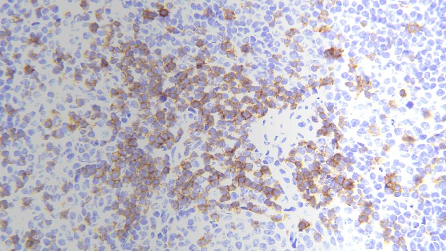 Spleen CD3 IHC