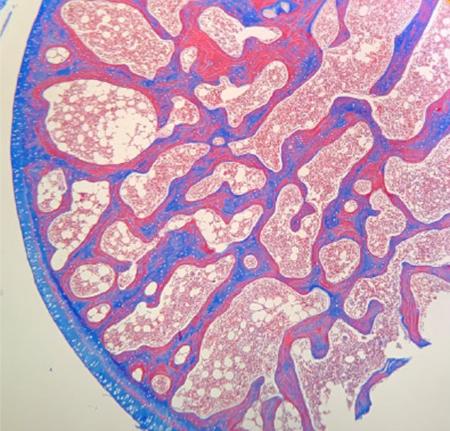 Masson’s Trichrome for the demonstration of collagen