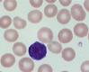 Blood Smear DiffQuik stain