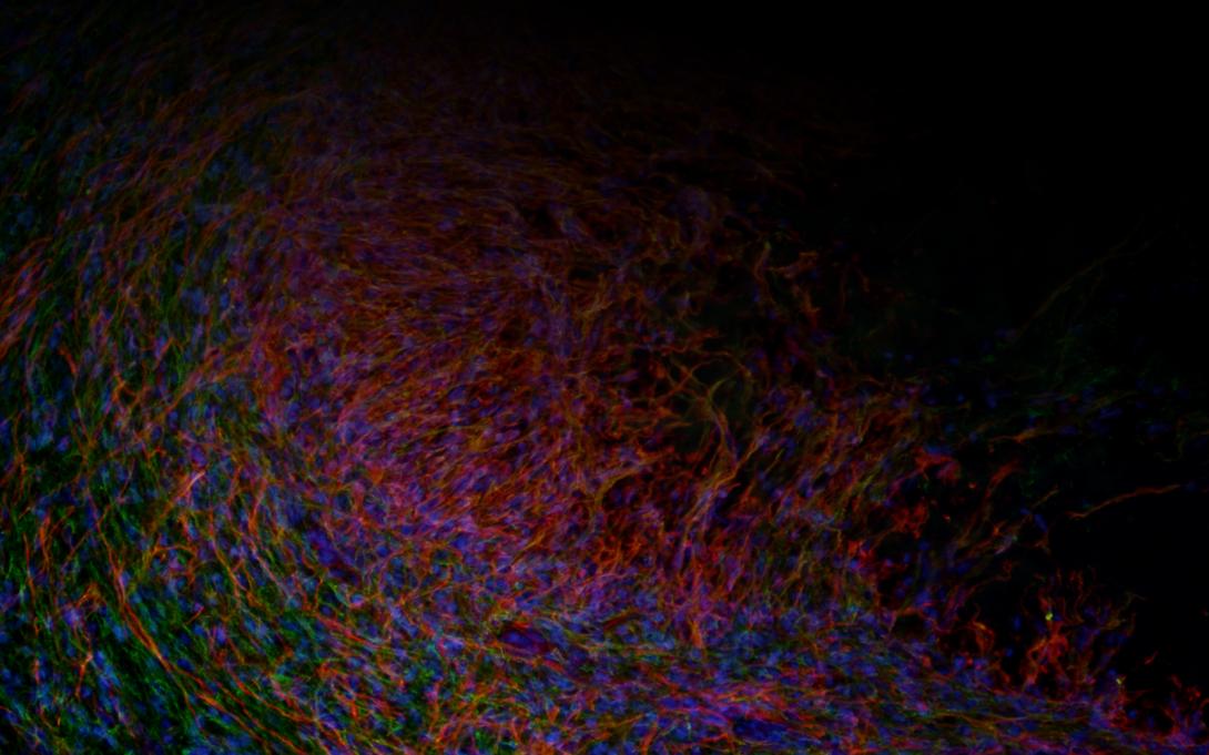 Implanted matrix gives structural support that promotes growth in brain tissue